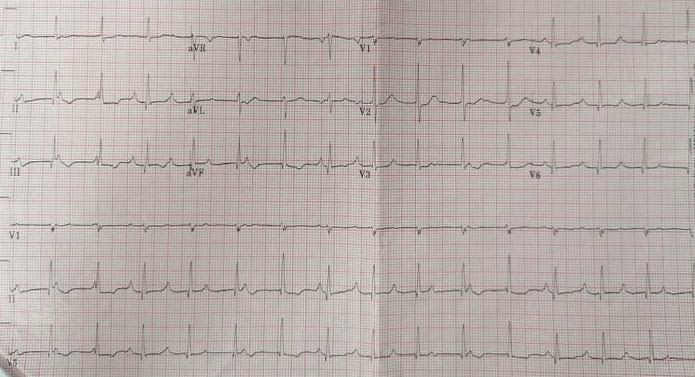 Dr Dave Richley ECG of the Month – February 2021