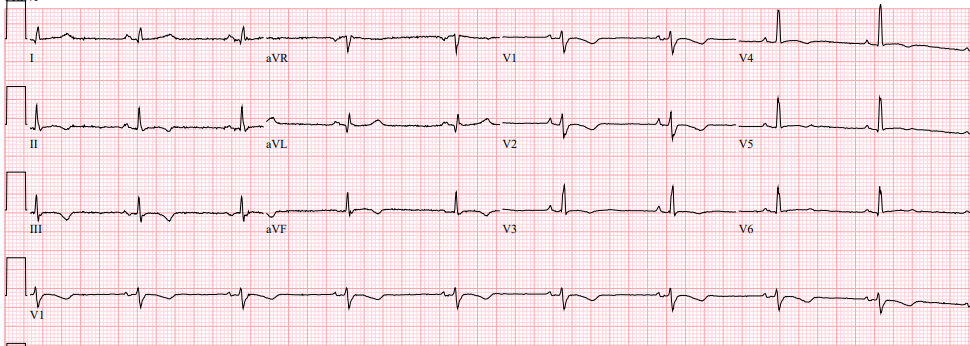 Dr Dave Richley ECG of the Month – March 2021