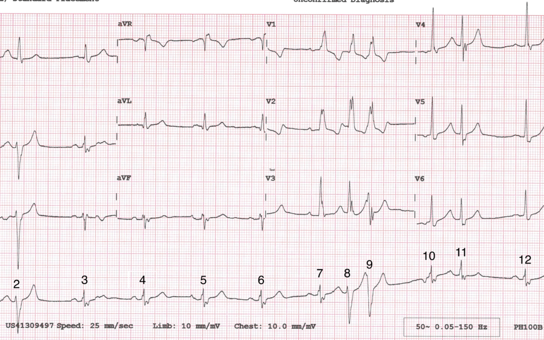 Dr Dave Richley ECG of the Month – September 2021