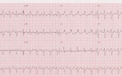 Dr Dave Richley ECG of the Month – October 2021