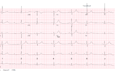 Dr Richleys ECG of the Month – July 2022