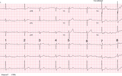Dr Richleys ECG of the Month – September 2022