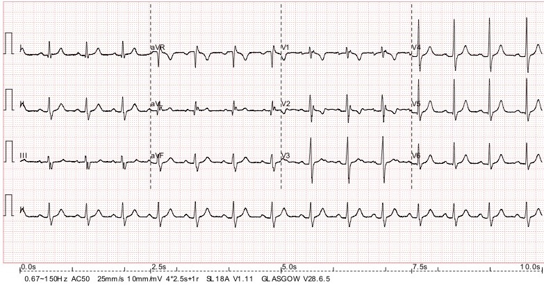 Dr Richleys ECG of the Month – October 2022