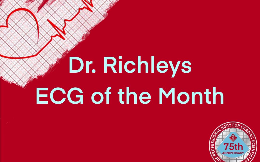 Dr Richleys ECG of the Month – December 2023