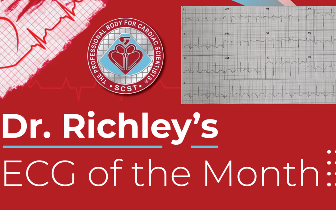 Dr Richleys ECG of the Month – July 2024