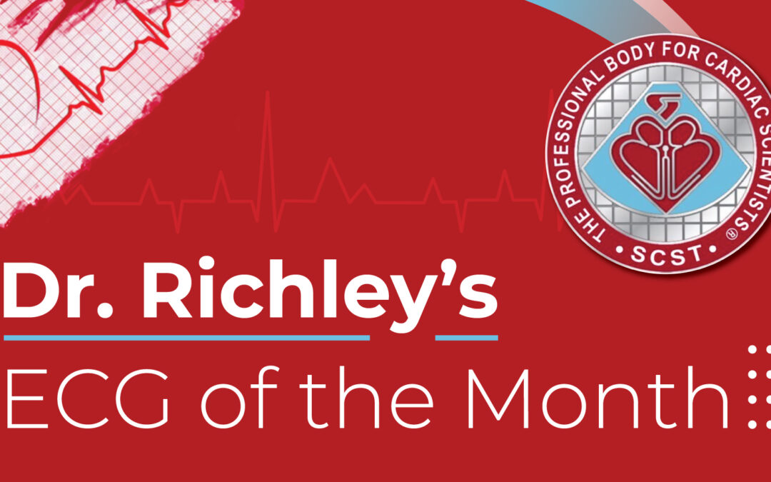 Dr Richleys ECG of the Month – February 2024